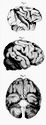 Gall 1810, Pl. XXXIV: Ansichten der Gehirnlappen