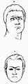 Fig. 71 - 72: Büste von Brutus / Zusammengewachsene Augenbrauen.