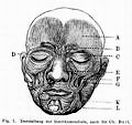 Fig. 1.: Darstellung der Gesichtsmuskel nach Sir Ch. Bell.