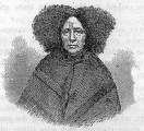 Fig. 19: Nach der Photographie einer geisteskranken Frau, um den Zustand ihres Haares zu zeigen